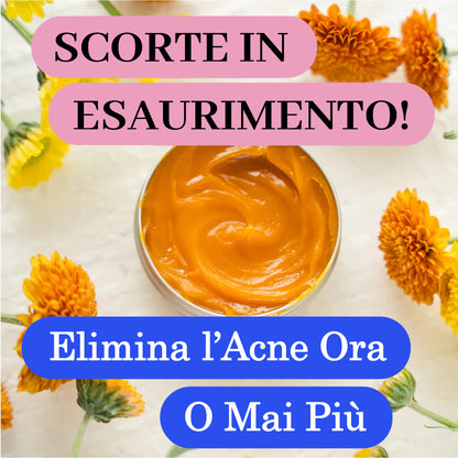 Routine Intensiva Anti-Acne