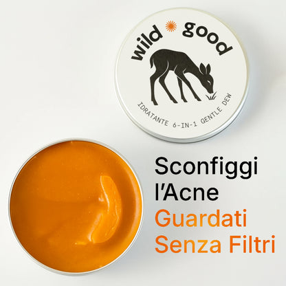 Routine Intensiva Anti-Acne