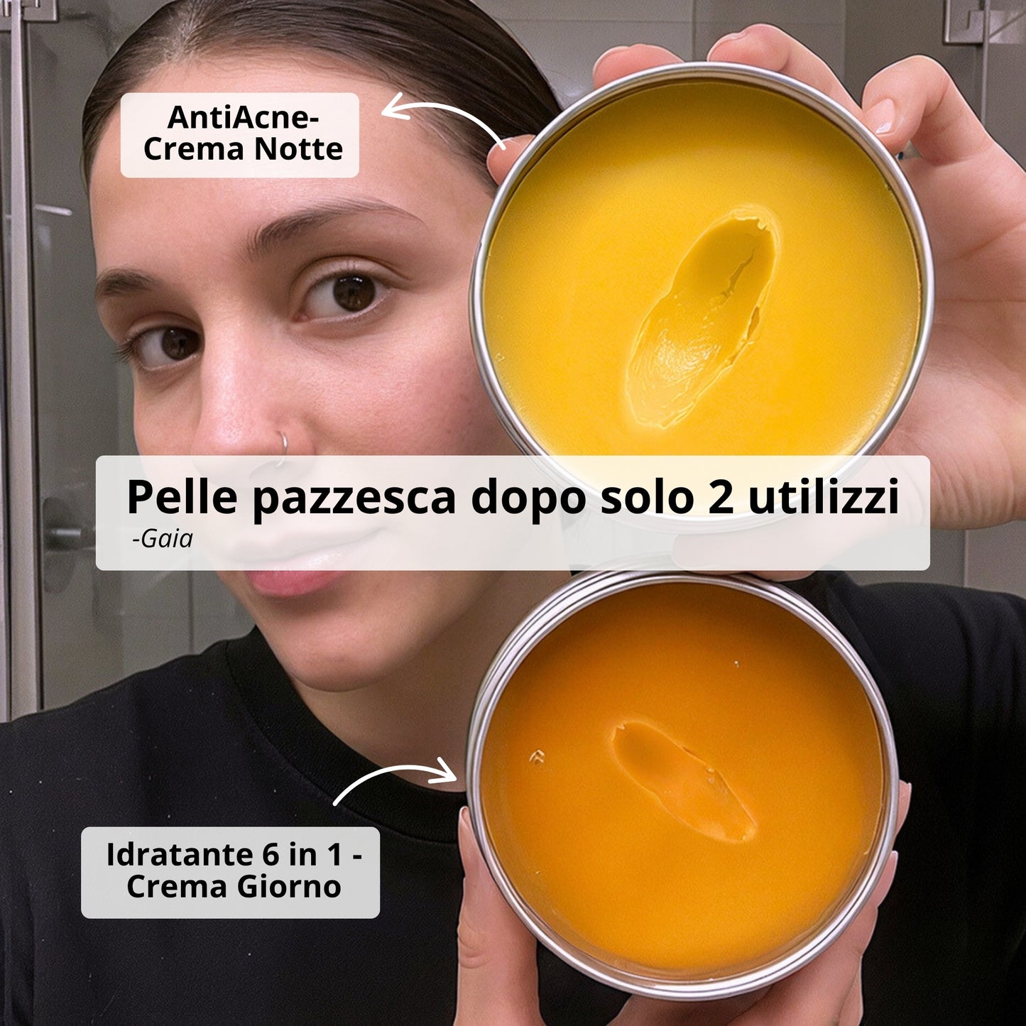 Routine Intensiva Anti-Acne